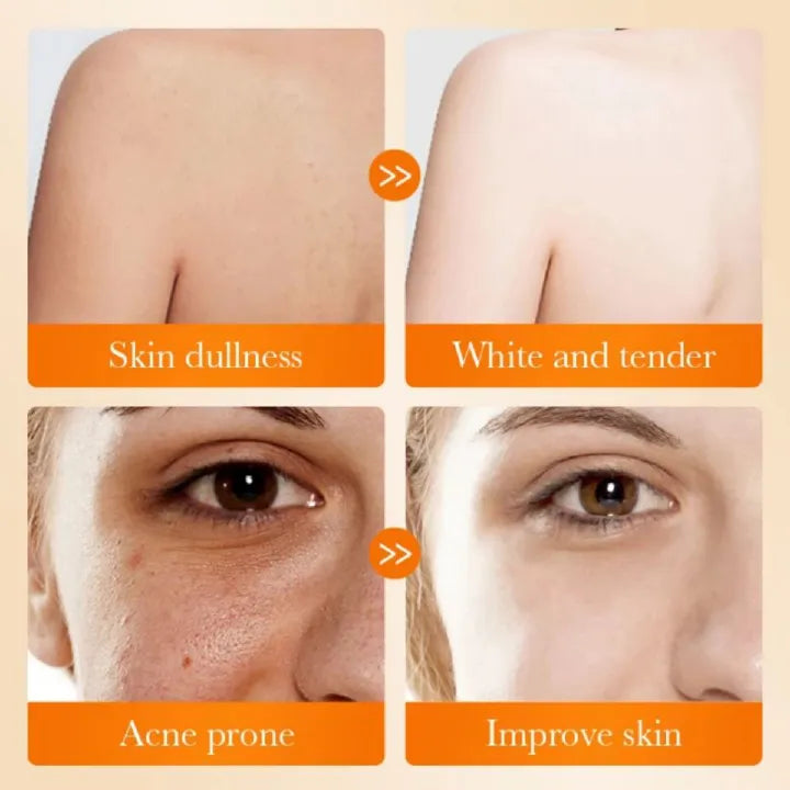 Sadoer Kojic Soap, Kojic Acid Whitening Soap, Deep Cleansing, Skin Brightening Like Vitamin C, Improve Acne Prone Skin, For Face and Body Skin Care