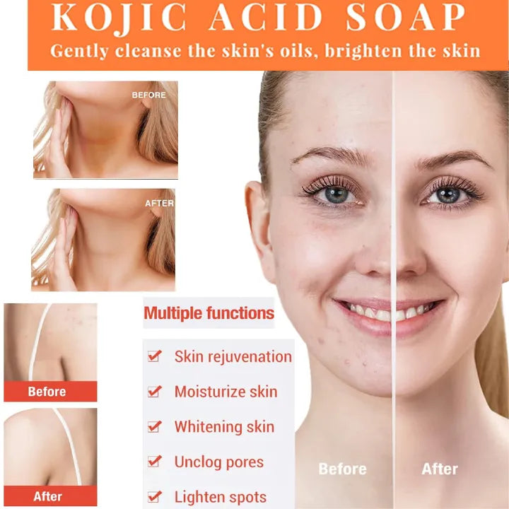 Kojic Acid Skin Brightening Soap 3Pcs * 65g, Facial Soap, Solid Soap Bar For Effectively Removing Acne Spots, And Used For Deeply Cleaning Face And Body Skin