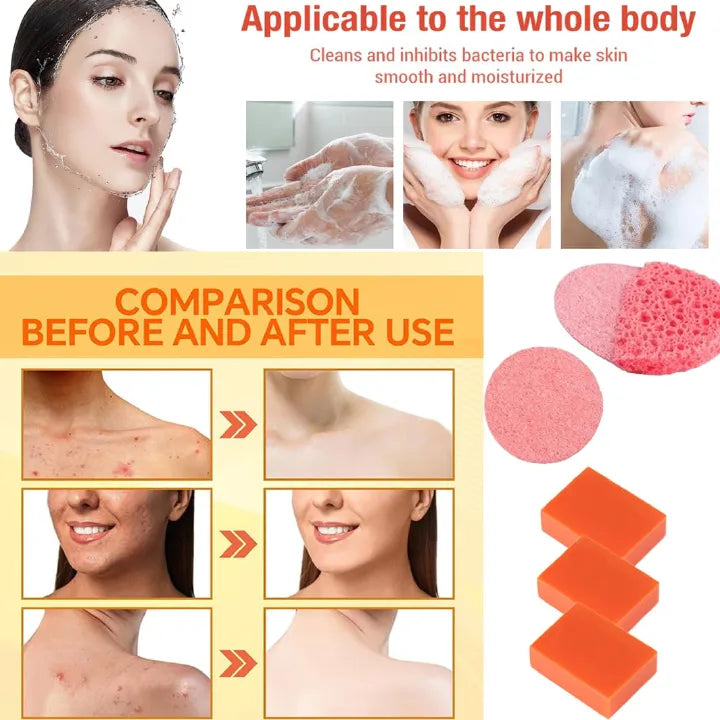Kojic Acid Skin Brightening Soap 3Pcs * 65g, Facial Soap, Solid Soap Bar For Effectively Removing Acne Spots, And Used For Deeply Cleaning Face And Body Skin
