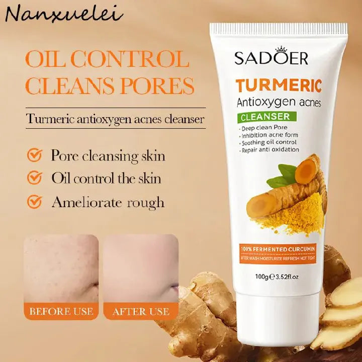 SADOER 8 Pieces Tumeric Skin Care Set: Turmeric Face Cream + Soap + Serum+ Toner + 3 Face Mask + Face Cleanser like Vitamin C For Treating Dark Spots, Anti-wrinkles & Improving Skin Texture, Smoothing