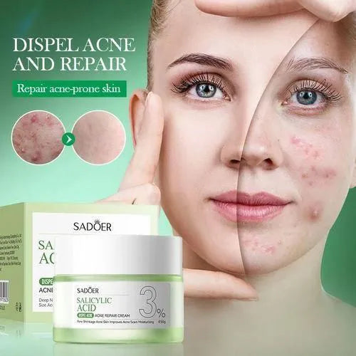 SADOER 4 in 1 ACNE REMOVAL SET!!! Salicylic Acid 3% Face Cleanser + Toner + Serum + Cream