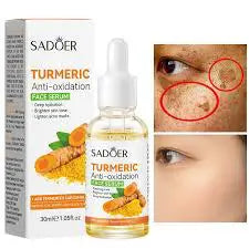SADOER 8 Pieces Tumeric Skin Care Set: Turmeric Face Cream + Soap + Serum+ Toner + 3 Face Mask + Face Cleanser like Vitamin C For Treating Dark Spots, Anti-wrinkles & Improving Skin Texture, Smoothing