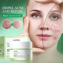SADOER 3 in 1 Set, Acne Repair Serum + Cream + Cleanser with 3% Salicylic Acid Collagen Peptide and Niacinamide, Centella Asiatica and Niacinamide, Can add Vitamin C,Remove Acne, Moisturize